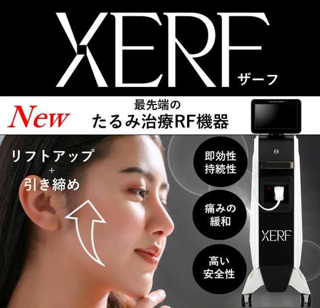 XERF（ザーフ）のイメージ画像