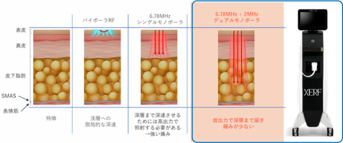 ＸＥＲＦについての説明画像