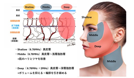 安全性と快適性への配慮の画像